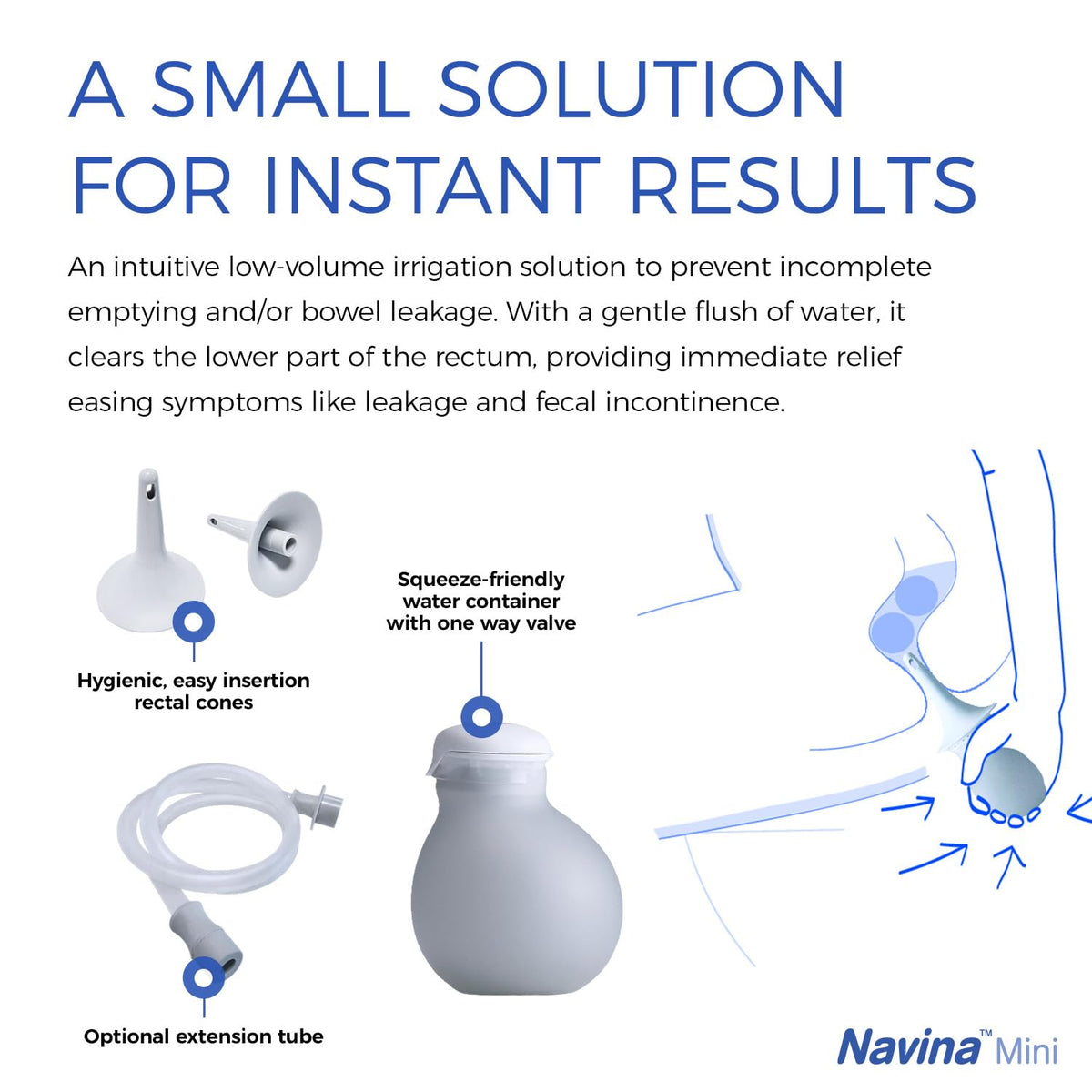 Low-Volume Enema Irrigation System with Water Bulb, Extension Tube, and 5 Rectal Cones K384